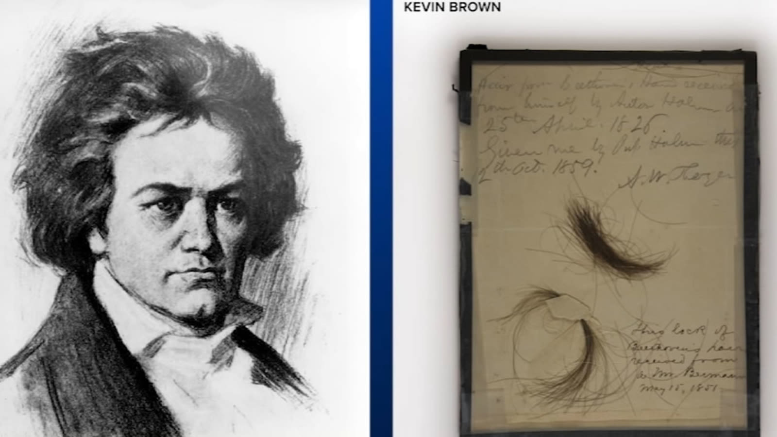 What caused Beethoven's death? Locks of hair once displayed at SJSU unlock mystery