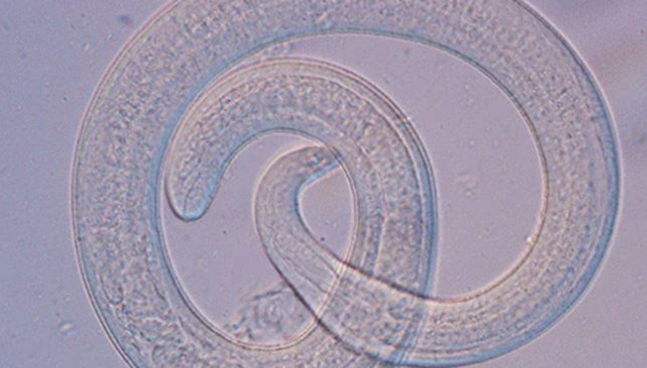 Undercooked bear meat to blame for infecting family with rare roundworm parasite: CDC