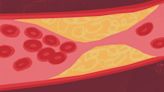 Here’s what cholesterol does to your body