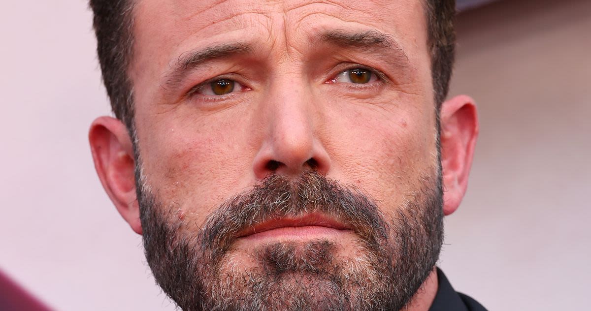 Ben Affleck Has ‘Resting Hard Face,’ Not RBF