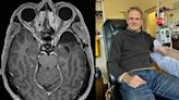 Médico se cura de cáncer cerebral terminal tras someterse a su propio tratamiento revolucionario