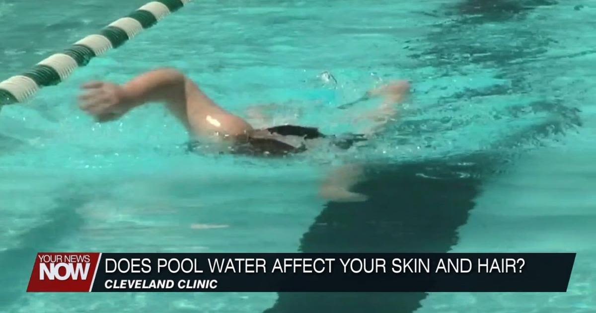 Does Pool Water Affect your Skin and Hair?