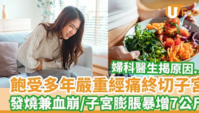飽受多年嚴重經痛終切子宮 發燒兼血崩/子宮膨脹暴增7公斤 | U Food 香港餐廳及飲食資訊優惠網站