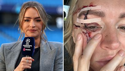 Laura Woods’ return to TV confirmed after horror injury in lampshade accident
