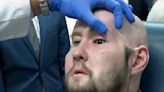 Man receives the first eye transplant plus a new face. It's a step toward one day restoring sight