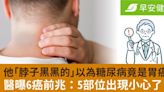 他「脖子黑黑的」以為糖尿病竟是胃癌！醫曝6癌前兆：5部位出現小心了