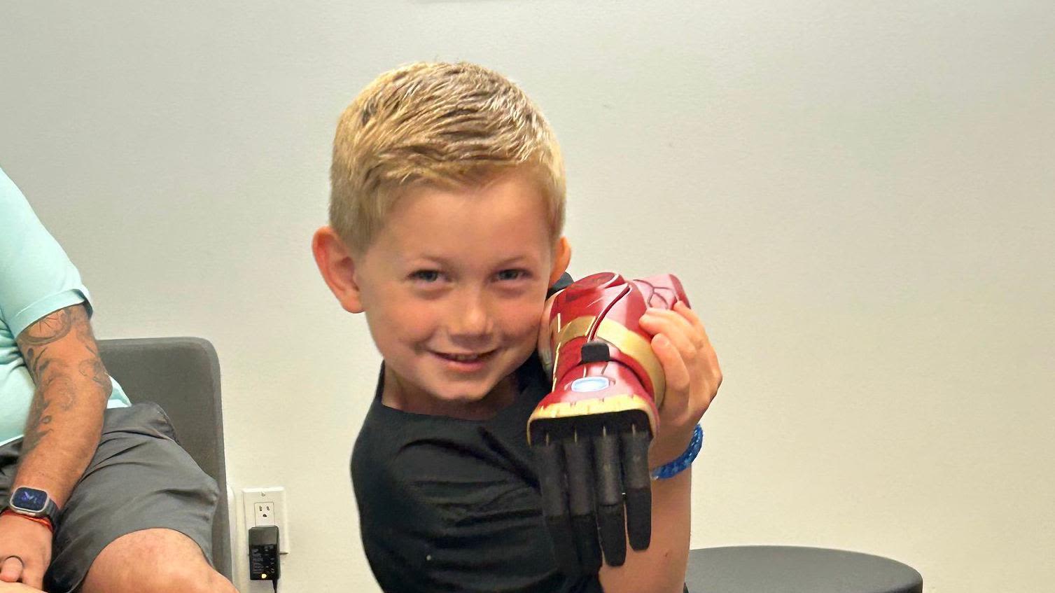 Boy, 5, is world’s youngest to use bionic hero arm