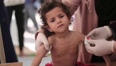 "El 30% de los menores en el norte de Gaza ya sufre desnutrición aguda y el número va en aumento"