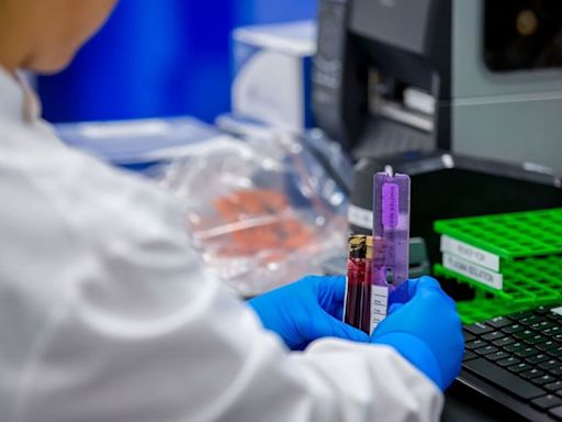Blood test to detect colon cancer could move a step closer to FDA approval in the US