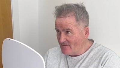 Richard Keys undergoes hair transplant treatment