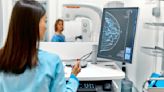 Cuál es la edad correcta para hacerte una mamografía, según médicos expertos de EE.UU. - La Opinión