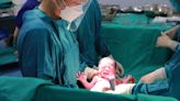 Study find newborn umbilical cord procedure safe for long-term neurodevelopment in children