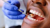 Free dental clinic aims to improve dental care of Black men