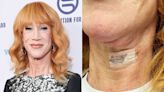 Kathy Griffin Reveals She’s Undergone Second Vocal Cord Surgery: ‘Worth It If I Get Some of My Voice Back’