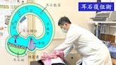 〈耳鳴暈眩保健專欄〉耳石症病因不同 復位術分階段完成