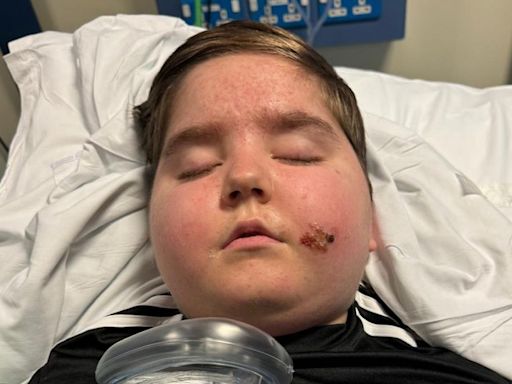 Boy told muscle pain was 'too much screen time' given months to live