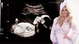 Kim Zolciak-Biermann Shares Sonogram Photo, Suggests Daughter Is Pregnant