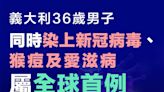 【全球首例】義大利36歲男子同時染上新冠病毒、猴痘及愛滋病