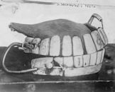 George Washington's teeth