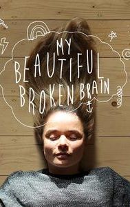 My Beautiful Broken Brain