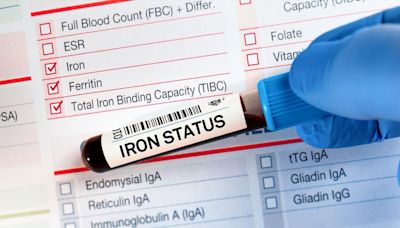 8 Signs You're Not Getting Enough Iron, Doctors Say