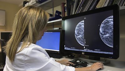 La edad y el grupo racial afectan la inteligencia artificial en los mamogramas digitales