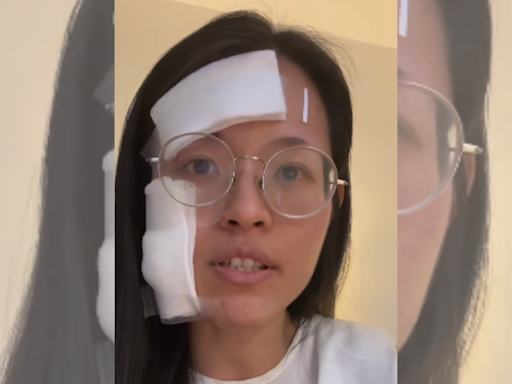 ‘Beat Me, Punched Me, Left Me In Blood’: Asian Woman Attacked By Drug Addict In NYC