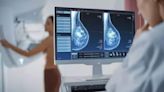 Regularidad en la mamografías en la Comunitat Valenciana con una media de 230.000 anuales desde 2011