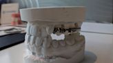 FDA said it never inspected dental lab that made controversial AGGA device