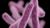 What to know about Shigella bacteria as drug-resistant strain spreads