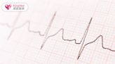 心房顫動全解析：識別、治療與生活調整的關鍵策略