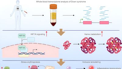 New research discovers differences in oxygen physiology in people with Down syndrome