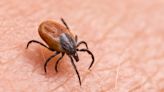Connecticut woman killed by rare tick-borne virus that caused chills, chest pain, and disorientation