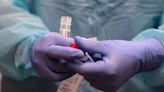 Monkeypox cases rising in Oregon as COVID-19 strains hospitals