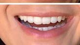 Shoppers' teeth are '10x whiter' after using £25 teeth whitening powder