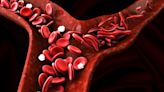 NHS to provide Pfizer’s Voxelotor to treat sickle cell disease