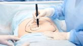 What Is Tummy Tuck Surgery? Expert Shares Benefits, Risks And Post-Surgery Care Tips