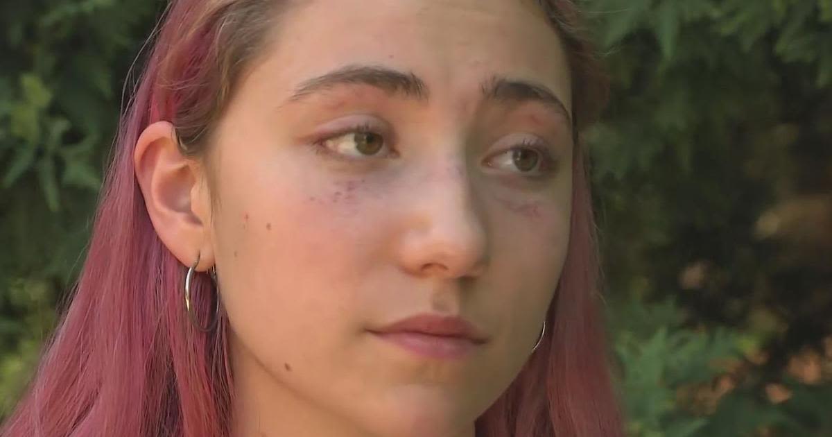18-year-old attacked by stranger in Downtown Pittsburgh