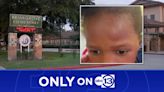 3-year-old student sent home from Houston ISD school with unexplained head injury