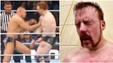Sheamus' chest after fighting Gunther on Monday Night Raw proves how brutal WWE can be