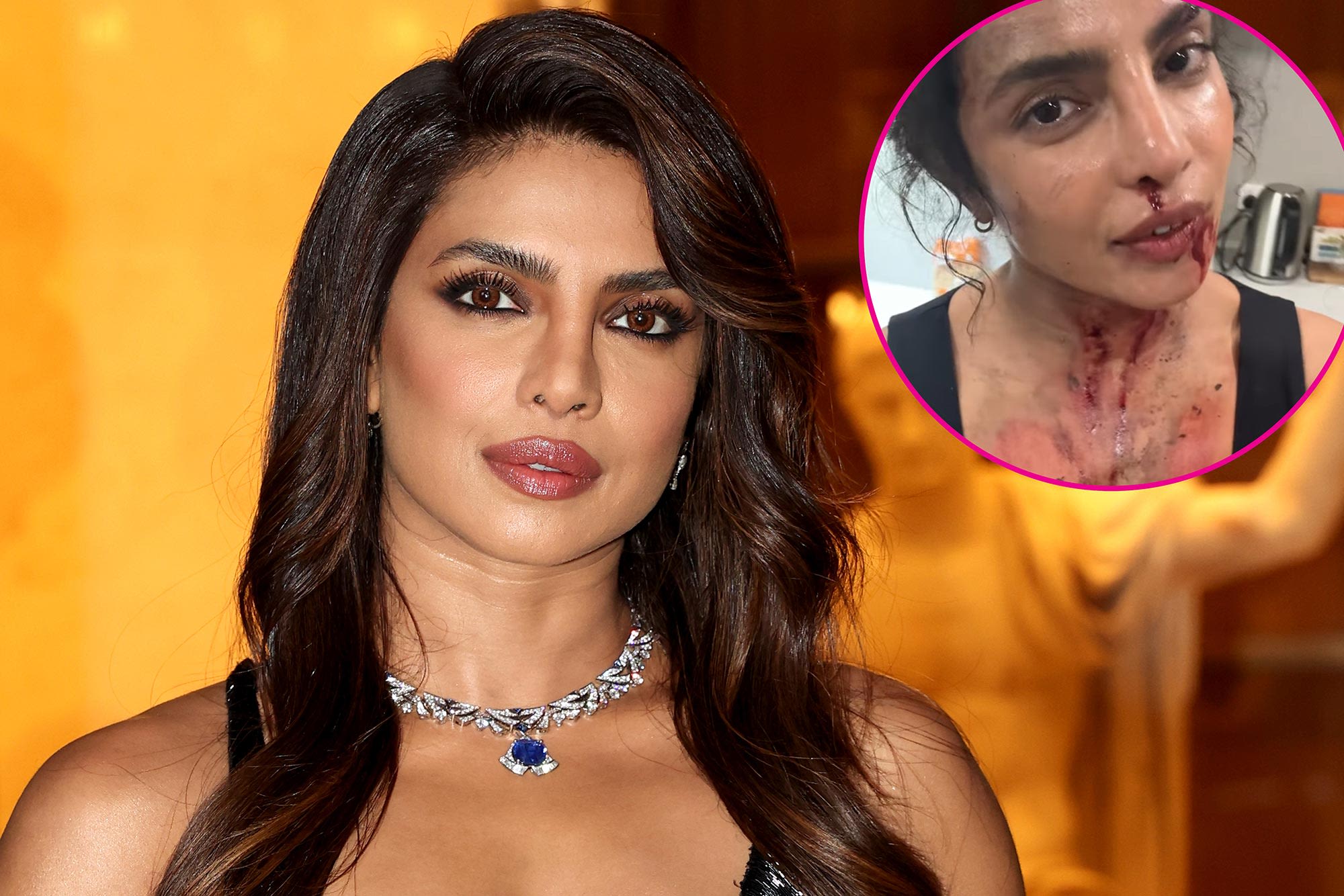 Priyanka Chopra Is Bruised and Bloody on ‘The Bluff’ Set : ‘Another Day at the Office’