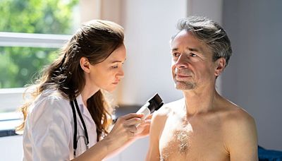 Prevalence of skin cancer varies for sexual minority, heterosexual adults