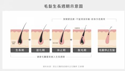 掉頭髮要吃什麼？醫揭4大「護髮營養」多吃維生素C、B群有助生髮