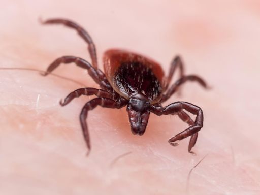 Could You Have Lyme Disease and Not Know It?