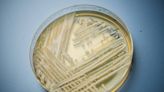 Washington faces first outbreak of a deadly fungal infection that's on the rise in the U.S.