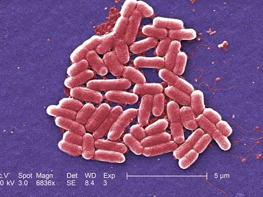 Legal action started against Tesco and Asda over E. coli outbreak