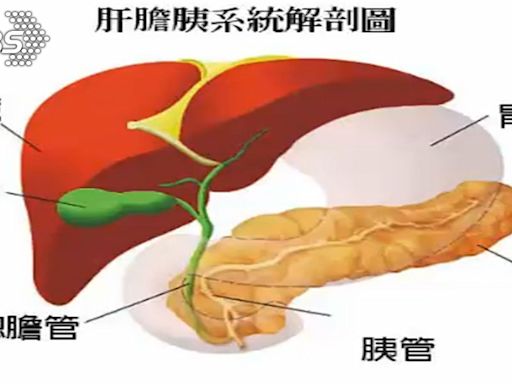 人體「這器官」長期發炎 小心「胰臟癌」高危險族群！