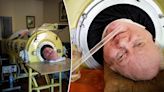 ‘Polio Paul’ Alexander, who spent 72 years inside iron lung, dead at 78