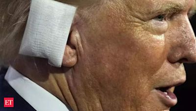 What is the ear reconstruction surgery that Donald Trump may have to undergo? - The Economic Times