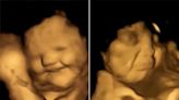 Babies in Womb Smile When Mother Eats Carrots, Frown When Given Kale, New Study Shows